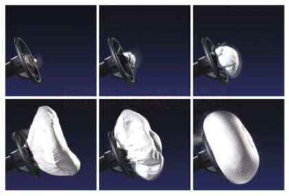 ¿Cómo funciona el airbag?