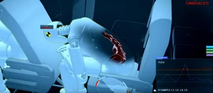 posicion-erronea-en-caso-de-accidente