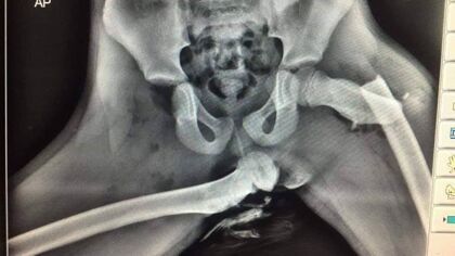 La radiografía que te enseña por qué no debes poner los pies en el salpicadero