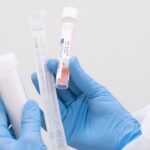 SEAT Test Coronavirus 4 150x150